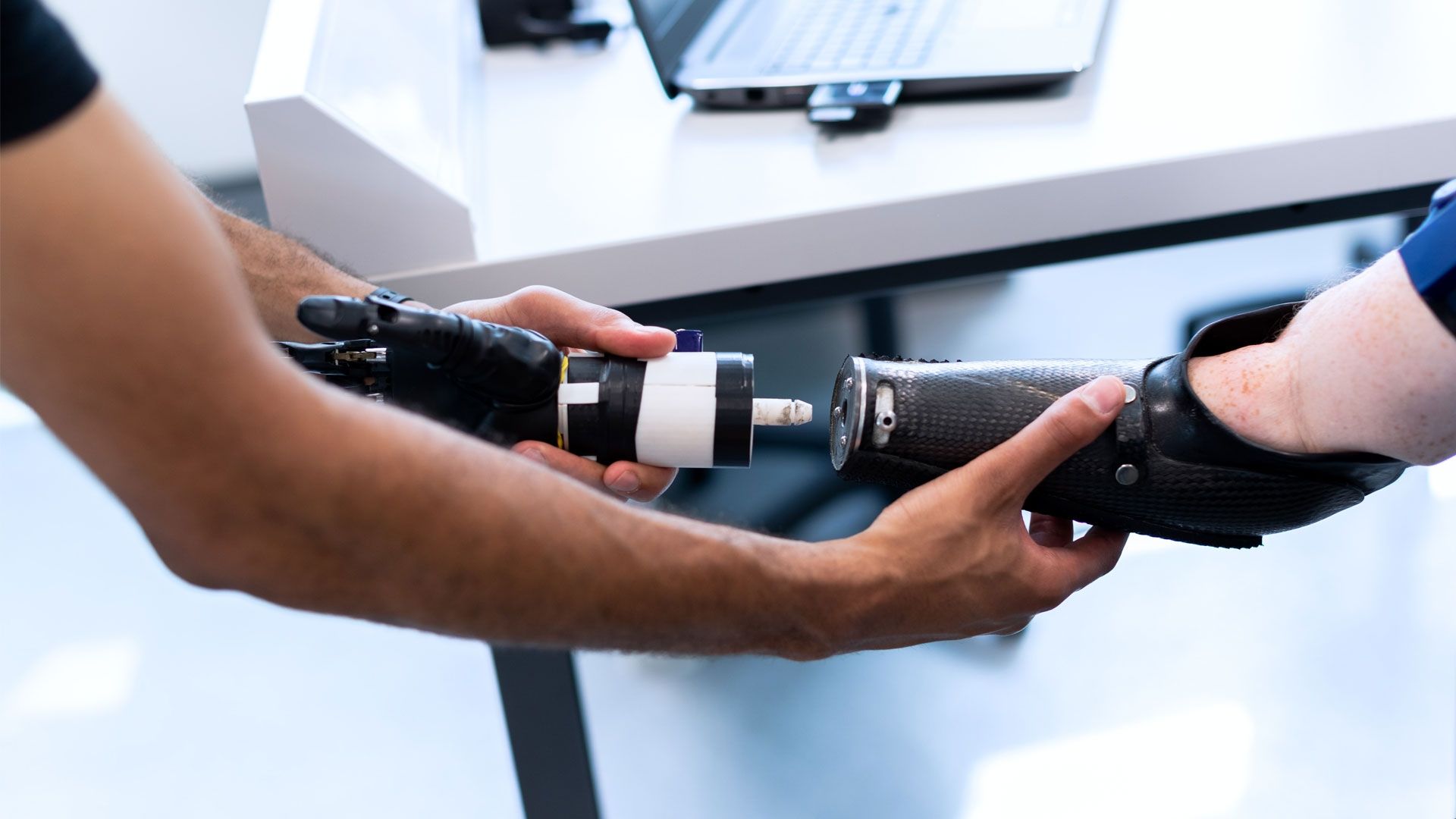 An amputee having a prosthetic hand attached to their arm.