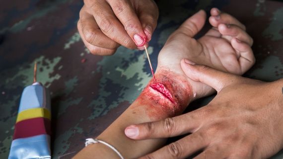 cut on arm for special effects work