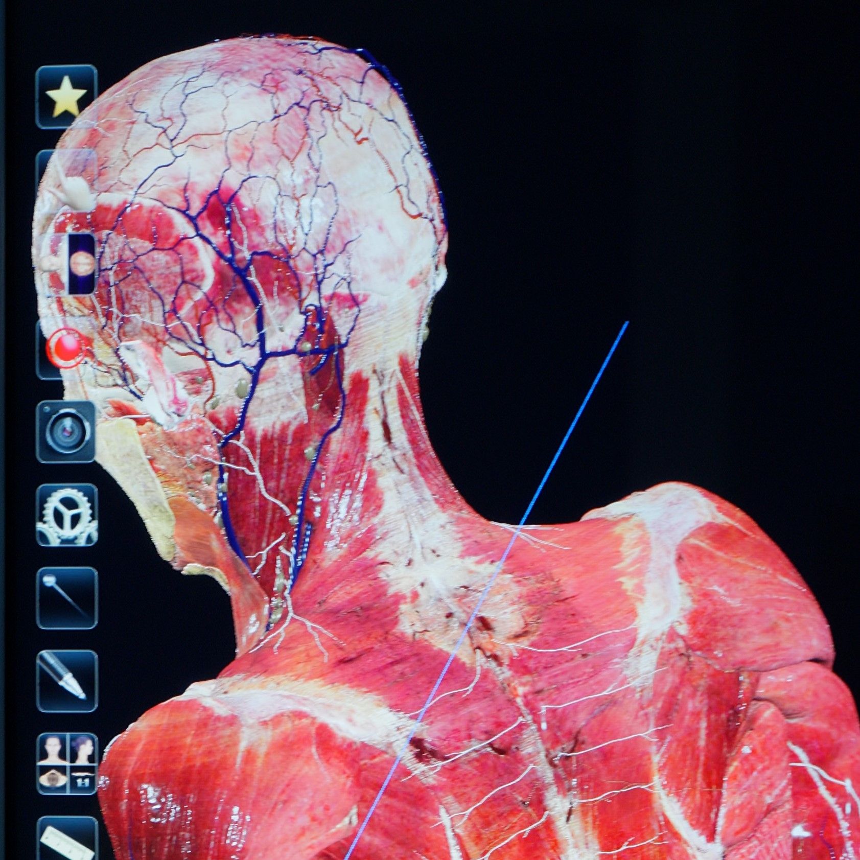 Muscles of a human showing on a digital screen - anatomage table.